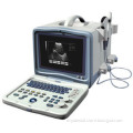 New Ce Approved Aj-6116 Full Digital Ultrasound Scanner